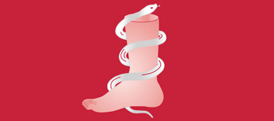 curs de malalties dels peus A. Viladot