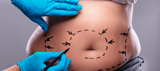 Seminari professional: Obesitat i sobrepès en medicina estètica
